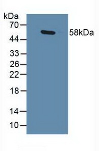 GABPA / NRF2 Antibody - Western Blot; Sample: Human Lung Tissue.