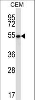 GABPA / NRF2 Antibody - GABPA Antibody western blot of CEM cell line lysates (35 ug/lane). The GABPA antibody detected the GABPA protein (arrow).