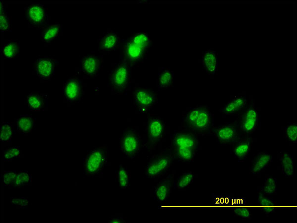 GABPA / NRF2 Antibody - Immunofluorescence of monoclonal antibody to GABPA on HeLa cell. [antibody concentration 40 ug/ml]
