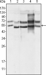 GABPA / NRF2 Antibody - Western blot using GABPA mouse monoclonal antibody against HeLa (1), A549 (2), MCF-7 (3), NIH/3T3 (4) and SMMC-7721 (5) cell lysate.