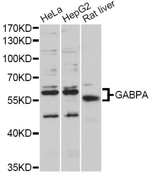 GABPA / NRF2 Antibody - Western blot analysis of extracts of various cell lines, using GABPA antibody at 1:1000 dilution. The secondary antibody used was an HRP Goat Anti-Rabbit IgG (H+L) at 1:10000 dilution. Lysates were loaded 25ug per lane and 3% nonfat dry milk in TBST was used for blocking. An ECL Kit was used for detection and the exposure time was 30s.