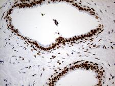 GABPB1 Antibody - Immunohistochemical staining of paraffin-embedded Human breast tissue within the normal limits using anti-GABPB1 mouse monoclonal antibody. (Heat-induced epitope retrieval by 1mM EDTA in 10mM Tris buffer. (pH8.5) at 120°C for 3 min. (1:500)