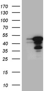GABPB1 Antibody - HEK293T cells were transfected with the pCMV6-ENTRY control. (Left lane) or pCMV6-ENTRY GABPB1. (Right lane) cDNA for 48 hrs and lysed. Equivalent amounts of cell lysates. (5 ug per lane) were separated by SDS-PAGE and immunoblotted with anti-GABPB1. (1:2000)