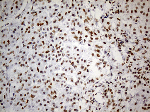 GABPB1 Antibody - Immunohistochemical staining of paraffin-embedded Human pancreas tissue within the normal limits using anti-GABPB1 mouse monoclonal antibody. (Heat-induced epitope retrieval by 1mM EDTA in 10mM Tris buffer. (pH8.5) at 120°C for 3 min. (1:500)