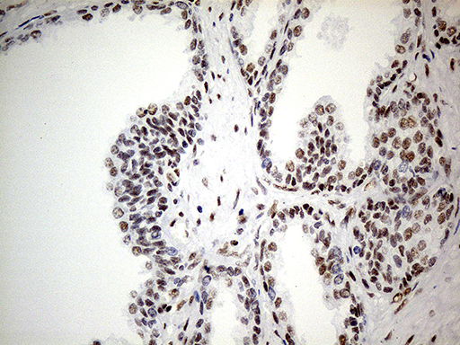 GABPB1 Antibody - Immunohistochemical staining of paraffin-embedded Human prostate tissue within the normal limits using anti-GABPB1 mouse monoclonal antibody. (Heat-induced epitope retrieval by 1mM EDTA in 10mM Tris buffer. (pH8.5) at 120°C for 3 min. (1:500)