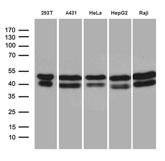 GABPB1 Antibody - Western blot analysis of extracts. (35ug) from 5 different cell lines by using anti-GABPB1 monoclonal antibody. (1:500)