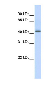 GABPB1 Antibody - GABPB2 antibody Western blot of HeLa lysate. This image was taken for the unconjugated form of this product. Other forms have not been tested.