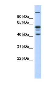 GABPB1 Antibody - GABPB2 antibody Anti-GA binding protein beta chain (GABPB2) Western blot of Fetal Muscle lysate.  This image was taken for the unconjugated form of this product. Other forms have not been tested.