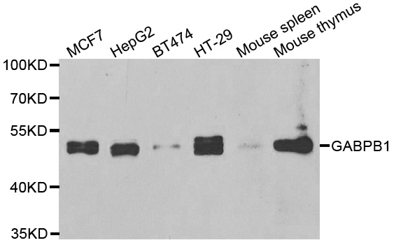 GABPB1 Antibody - Western blot analysis of extracts of various cell lines.