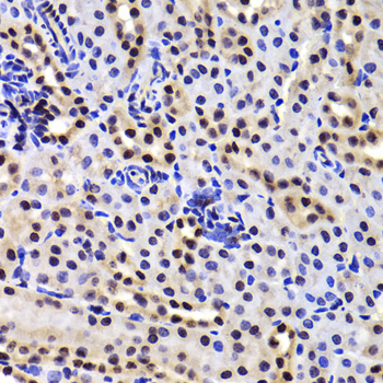 GABPB1 Antibody - Immunohistochemistry of paraffin-embedded Mouse kidney tissue.
