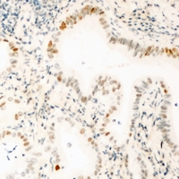 GABPB1 Antibody - Immunohistochemical analysis of GABPB1 staining in mouse kidney formalin fixed paraffin embedded tissue section. The section was pre-treated using heat mediated antigen retrieval with sodium citrate buffer (pH 6.0). The section was then incubated with the antibody at room temperature and detected using an HRP conjugated compact polymer system. DAB was used as the chromogen. The section was then counterstained with hematoxylin and mounted with DPX.