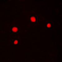 GABPB1 Antibody - Immunofluorescent analysis of GABPB1 staining in HeLa cells. Formalin-fixed cells were permeabilized with 0.1% Triton X-100 in TBS for 5-10 minutes and blocked with 3% BSA-PBS for 30 minutes at room temperature. Cells were probed with the primary antibody in 3% BSA-PBS and incubated overnight at 4 deg C in a humidified chamber. Cells were washed with PBST and incubated with a DyLight 594-conjugated secondary antibody (red) in PBS at room temperature in the dark.