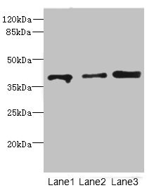 GABPB1 Antibody - Western blot All Lanes: GABPB1antibody at 1.11ug/ml Lane 1 : Rat gonadal tissue Lane 2 : Hela whole cell lysate Lane 3 : HT29 whole cell lysate Secondary Goat polyclonal to Rabbit IgG at 1/10000 dilution Predicted band size: 43,42,39,37 kDa Observed band size: 42 kDa