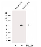 GABPB1 Antibody - Western blot analysis of extracts of mouse lung tissue using GABPB1 antibody. The lane on the left was treated with blocking peptide.
