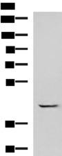 GABPB1 Antibody - Western blot analysis of A549 cell lysate  using GABPB1 Polyclonal Antibody at dilution of 1:1000