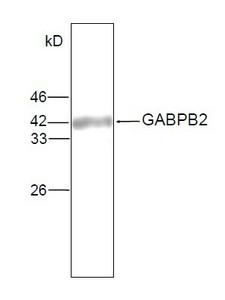 GABPB2 Antibody