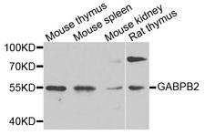 GABPB2 Antibody - Western blot analysis of extracts of various cells.