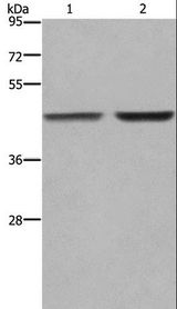 GABPB2 Antibody - Western blot analysis of MCF-7 and 231 cell, using GABPB2 Polyclonal Antibody at dilution of 1:550.