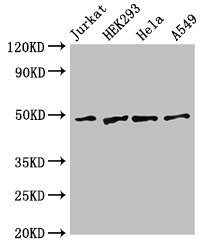 GABPB2 Antibody - Western Blot Positive WB detected in:Jurkat whole cell lysate,HEK293 whole cell lysate,Hela whole cell lysate,A549 whole cell lysate All Lanes:GABPB2 antibody at 2.5µg/ml Secondary Goat polyclonal to rabbit IgG at 1/50000 dilution Predicted band size: 49 KDa Observed band size: 49 KDa