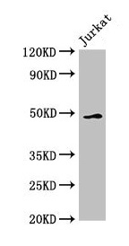 GABPB2 Antibody - Western Blot Positive WB detected in: Jurkat whole cell lysate All lanes: GABPB2 antibody at 2.5µg/ml Secondary Goat polyclonal to rabbit IgG at 1/50000 dilution Predicted band size: 49 kDa Observed band size: 49 kDa