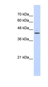 GABPB2 Antibody - GABPB2 antibody Western blot of Transfected 293T cell lysate. This image was taken for the unconjugated form of this product. Other forms have not been tested.
