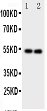 GABRA1 Antibody - Anti-GABA A Receptor alpha 1 antibody, Western blotting Lane 1: Rat Brain Tissue LysateLane 2: Rat Brain Tissue Lysate