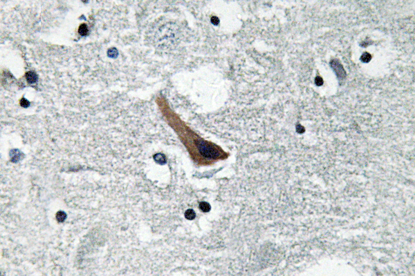 GABRA1 Antibody - IHC of GABAA R1 (L361) pAb in paraffin-embedded human brain tissue.