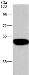 GABRA1 Antibody - Western blot analysis of LoVo cell, using GABRA1 Polyclonal Antibody at dilution of 1:300.