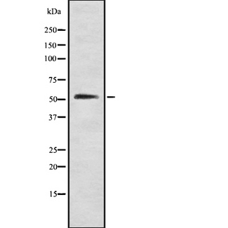 GABRA1 Antibody - Western blot analysis GABAA R alpha1 using HeLa whole cells lysates