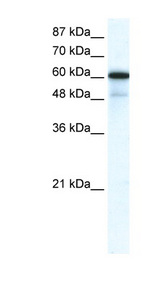 GABRA1 Antibody - GABRA1 antibody Western blot of HepG2 cell lysate. This image was taken for the unconjugated form of this product. Other forms have not been tested.