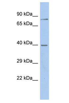 GABRA2 Antibody - GABRA2 antibody Western Blot of OVCAR-3. Antibody dilution: 1 ug/ml.  This image was taken for the unconjugated form of this product. Other forms have not been tested.