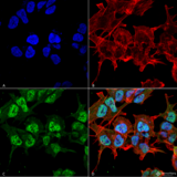 GABRA2 Antibody - Immunocytochemistry/Immunofluorescence analysis using Mouse Anti-GABA-A Receptor Alpha2 Monoclonal Antibody, Clone S399-19. Tissue: Neuroblastoma cell line (SK-N-BE). Species: Human. Fixation: 4% Formaldehyde for 15 min at RT. Primary Antibody: Mouse Anti-GABA-A Receptor Alpha2 Monoclonal Antibody  at 1:100 for 60 min at RT. Secondary Antibody: Goat Anti-Mouse ATTO 488 at 1:100 for 60 min at RT. Counterstain: Phalloidin Texas Red F-Actin stain; DAPI (blue) nuclear stain at 1:1000; 1:5000 for 60 min RT, 5 min RT. Localization: Cytoplasm, Nucleus. Magnification: 60X. (A) DAPI (blue) nuclear stain. (B) Phalloidin Texas Red F-Actin stain. (C) GABA-A Receptor Alpha2 Antibody. (D) Composite.