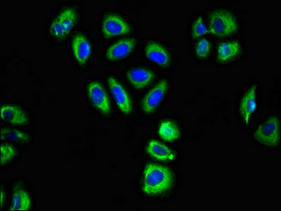 GABRA2 Antibody - Immunofluorescent analysis of A549 cells diluted at 1:100 and Alexa Fluor 488-congugated AffiniPure Goat Anti-Rabbit IgG(H+L)