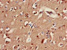 GABRA2 Antibody - Immunohistochemistry of paraffin-embedded human brain tissue at dilution of 1:100