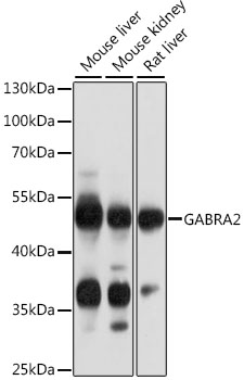 GABRA2 Antibody - Western blot analysis of extracts of various cell lines, using GABRA2 antibody at 1:1000 dilution. The secondary antibody used was an HRP Goat Anti-Rabbit IgG (H+L) at 1:10000 dilution. Lysates were loaded 25ug per lane and 3% nonfat dry milk in TBST was used for blocking. An ECL Kit was used for detection and the exposure time was 3s.