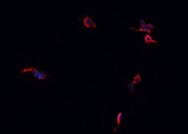 GABRA2 Antibody - Staining HepG2 cells by IF/ICC. The samples were fixed with PFA and permeabilized in 0.1% Triton X-100, then blocked in 10% serum for 45 min at 25°C. The primary antibody was diluted at 1:200 and incubated with the sample for 1 hour at 37°C. An Alexa Fluor 594 conjugated goat anti-rabbit IgG (H+L) antibody, diluted at 1/600, was used as secondary antibody.