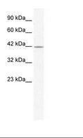 GABRA3 Antibody - Jurkat Cell Lysate.  This image was taken for the unconjugated form of this product. Other forms have not been tested.