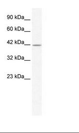 GABRA3 Antibody - Jurkat Cell Lysate.  This image was taken for the unconjugated form of this product. Other forms have not been tested.