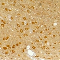 GABRA3 Antibody - Immunohistochemical analysis of GABRA3 staining in rat brain;mouse brain formalin fixed paraffin embedded tissue section. The section was pre-treated using heat mediated antigen retrieval with sodium citrate buffer (pH 6.0). The section was then incubated with the antibody at room temperature and detected using an HRP conjugated compact polymer system. DAB was used as the chromogen. The section was then counterstained with hematoxylin and mounted with DPX.