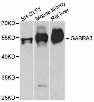 GABRA3 Antibody - Western blot analysis of extracts of various cell lines, using GABRA3 antibody at 1:3000 dilution. The secondary antibody used was an HRP Goat Anti-Rabbit IgG (H+L) at 1:10000 dilution. Lysates were loaded 25ug per lane and 3% nonfat dry milk in TBST was used for blocking. An ECL Kit was used for detection and the exposure time was 30s.