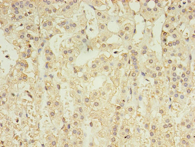 GABRA4 Antibody - Immunohistochemistry of paraffin-embedded human kidney tissue using GABRA4 Antibody at dilution of 1:100