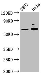 GABRA4 Antibody - Western blot All lanes: GABRA4 antibody at 2µg/ml + Mouse kidney tissue Secondary Goat polyclonal to rabbit IgG at 1/10000 dilution Predicted band size: 62 kDa Observed band size: 62 kDa