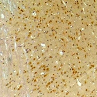 GABRA4 Antibody - Immunohistochemical analysis of GABRA4 staining in rat brain;mouse brain formalin fixed paraffin embedded tissue section. The section was pre-treated using heat mediated antigen retrieval with sodium citrate buffer (pH 6.0). The section was then incubated with the antibody at room temperature and detected using an HRP conjugated compact polymer system. DAB was used as the chromogen. The section was then counterstained with hematoxylin and mounted with DPX.