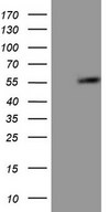 GABRA5 Antibody - HEK293T cells were transfected with the pCMV6-ENTRY control (Left lane) or pCMV6-ENTRY GABRA5 (Right lane) cDNA for 48 hrs and lysed. Equivalent amounts of cell lysates (5 ug per lane) were separated by SDS-PAGE and immunoblotted with anti-GABRA5.