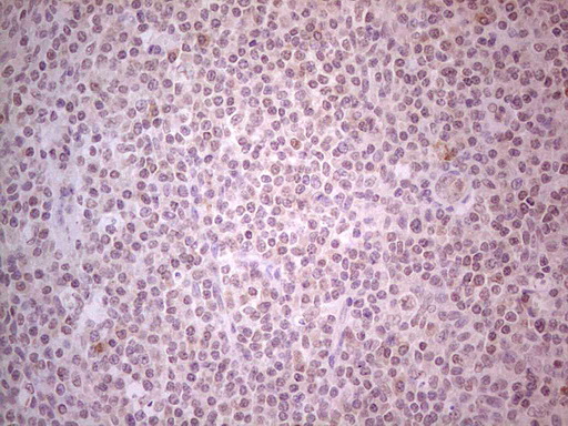 GABRA5 Antibody - Immunohistochemical staining of paraffin-embedded Human tonsil within the normal limits using anti-GABRA5 mouse monoclonal antibody. (Heat-induced epitope retrieval by Tris-EDTA, pH8.0) Dilution: 1:150