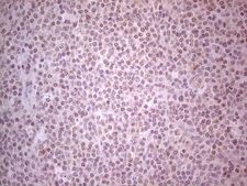 GABRA5 Antibody - Immunohistochemical staining of paraffin-embedded Human tonsil within the normal limits using anti-GABRA5 mouse monoclonal antibody. (Heat-induced epitope retrieval by Tris-EDTA, pH8.0) Dilution: 1:150