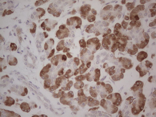 GABRA5 Antibody - Immunohistochemical staining of paraffin-embedded Carcinoma of Human pancreas tissue using anti-GABRA5 mouse monoclonal antibody. (Heat-induced epitope retrieval by Tris-EDTA, pH8.0) Dilution: 1:150