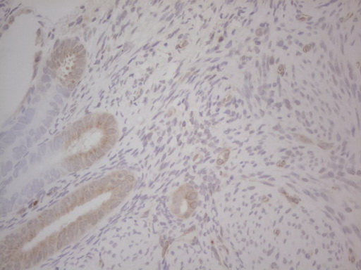 GABRA5 Antibody - Immunohistochemical staining of paraffin-embedded Human endometrium tissue within the normal limits using anti-GABRA5 mouse monoclonal antibody. (Heat-induced epitope retrieval by Tris-EDTA, pH8.0) Dilution: 1:150