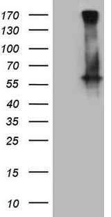 GABRA5 Antibody - HEK293T cells were transfected with the pCMV6-ENTRY control. (Left lane) or pCMV6-ENTRY GABRA5. (Right lane) cDNA for 48 hrs and lysed. Equivalent amounts of cell lysates. (5 ug per lane) were separated by SDS-PAGE and immunoblotted with anti-GABRA5. (1:2000)