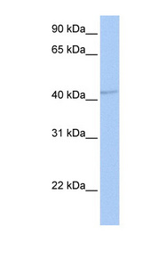 GABRA5 Antibody - GABRA5 antibody Western blot of Fetal Brain lysate. This image was taken for the unconjugated form of this product. Other forms have not been tested.